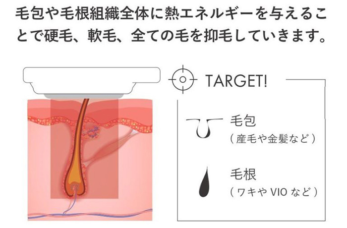 ハイブリッド脱毛とは